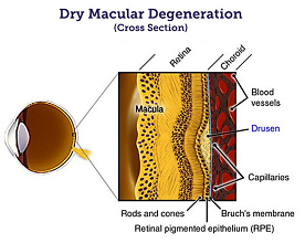 Dry AMD Anatomy